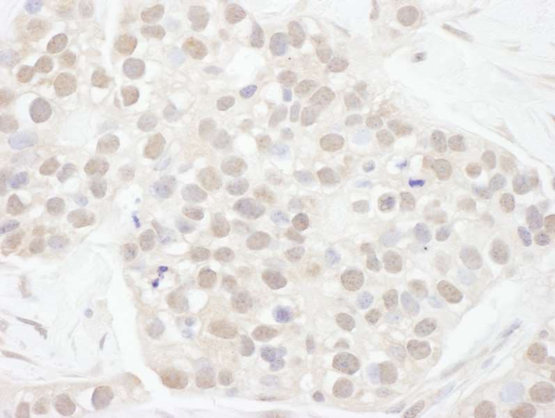 CCNT1 / Cyclin T1 Antibody (aa425-475)
