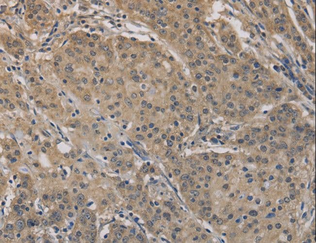 AGTRAP / ATRAP Antibody
