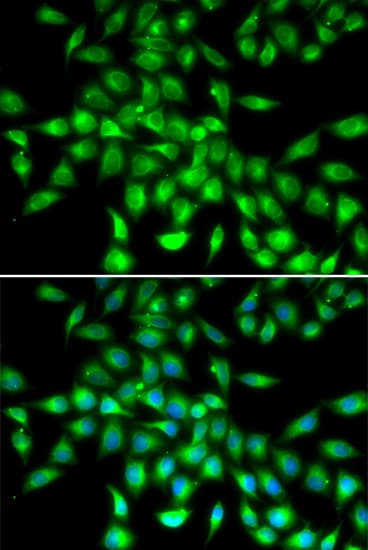 SERPINA10 / PZI Antibody