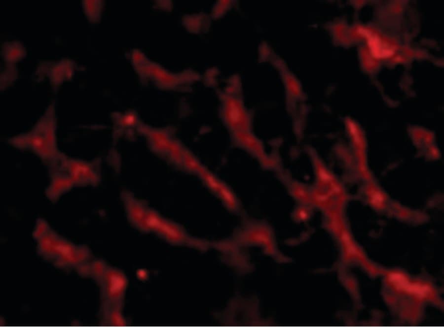 IHC-plus™ TNFRSF12A / TWEAK Receptor Antibody