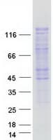 Human SMARCAD1 Protein (Recombinant Myc-DDK (Flag))