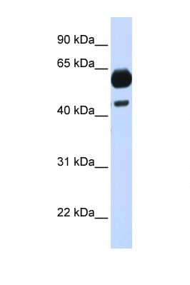 CDC25A Antibody (C-Terminus)