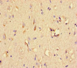 STAT1 Antibody