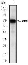 MMP2 Antibody (Amino Acid: 242-396, clone 4D1E2)