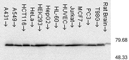 Monoclonal Mouse anti-Human HSP70 / Heat Shock Protein 70 Antibody (clone C92F3A-5, IHC, WB)