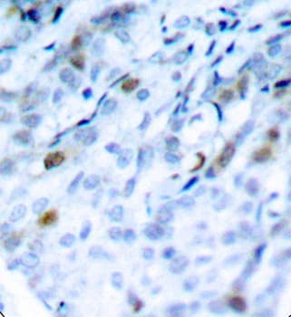 Polyclonal Rabbit anti-Human CDK1 / CDC2 Antibody (phospho-Thr161, IHC, WB)