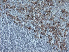 MAPK9 / JNK2 Antibody (clone OTI2D11)