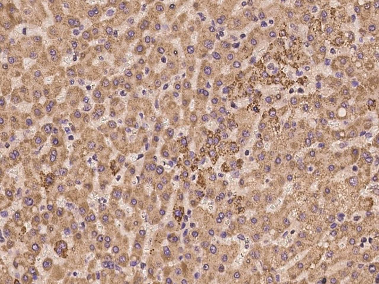 ADAM15 Antibody