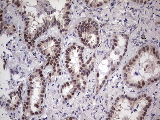TNNT2 / CTNT Antibody (clone OTI3H2)