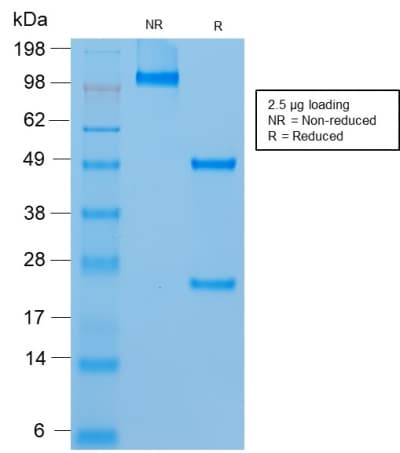 Recombinant Monoclonal Mouse anti-Human MCAM / CD146 Antibody (clone rMUC18/1130, Azide-free,Carrier-free, IHC)