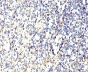 ACP5 / TRAP Antibody (clone SPM601)
