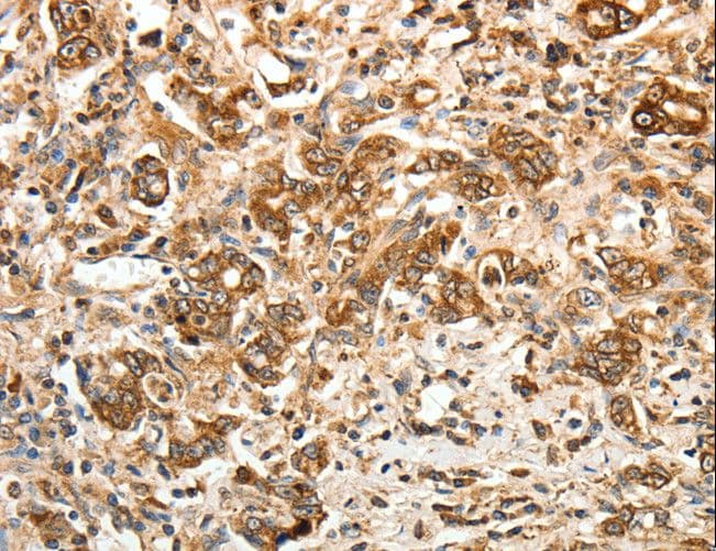 CALR / Calreticulin Antibody