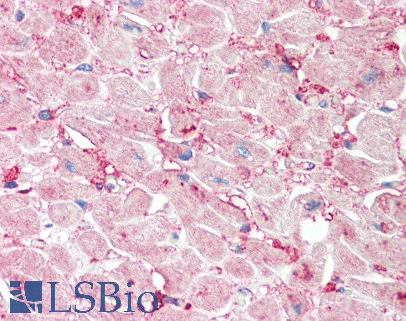 IHC-plus™ Polyclonal Rabbit anti-Human MAPK6 / ERK3 Antibody (aa461-510, IHC, IF, WB)