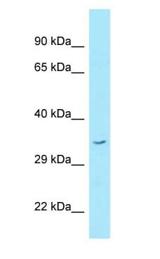 STX16 / Syntaxin 16 Antibody (C-Terminus)