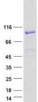 Human TBC1D5 Protein (Recombinant Myc-DDK (Flag))
