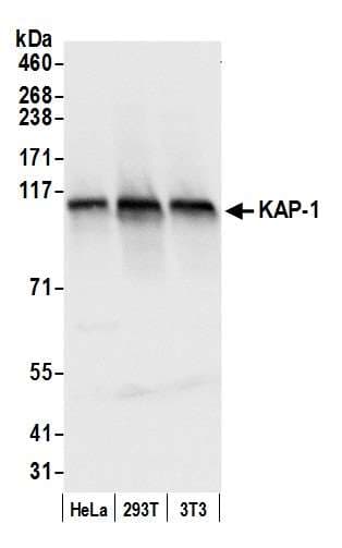 Polyclonal Rabbit anti-Human TRIM28 / KAP1 Antibody (aa650-700, IHC, WB)