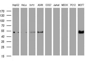 Selenium Binding Protein 1 Antibody (clone OTI3H1)