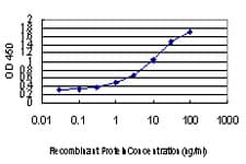 Monoclonal Mouse anti-Human VHL / Von Hippel Lindau Antibody (clone 1G12, IF, WB)