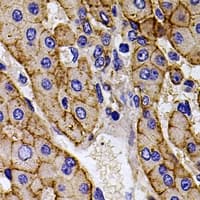 CAPNS1 / CAPN4 Antibody
