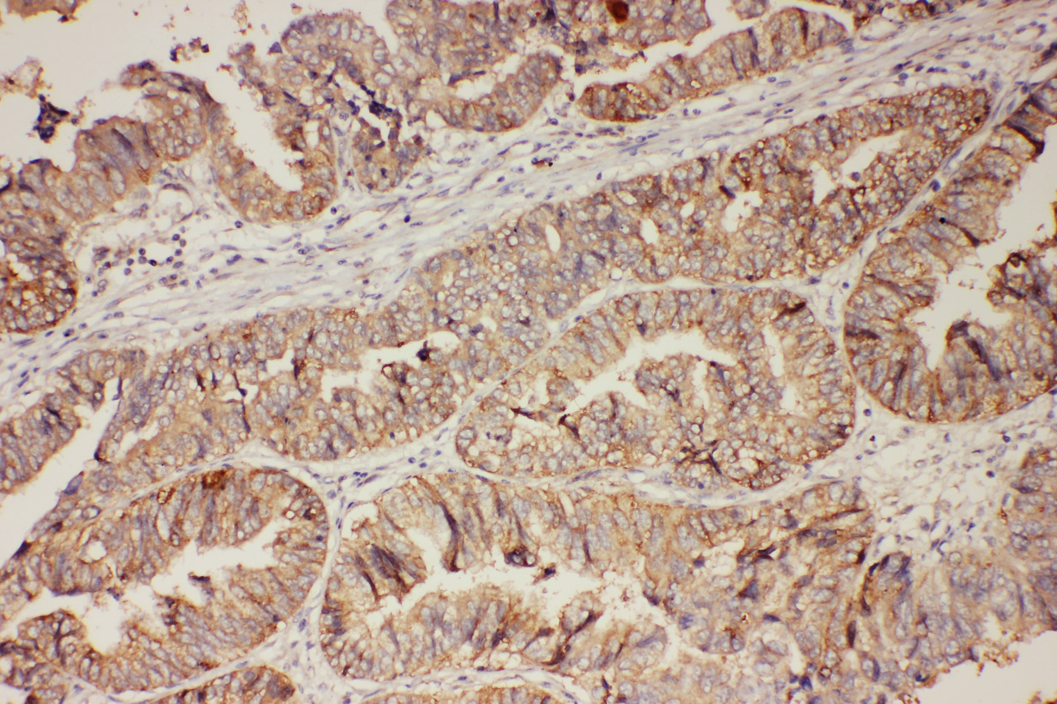 PR / Progesterone Receptor Antibody (aa595-933)