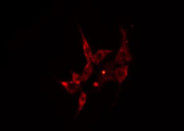 Polyclonal Rabbit anti-Human ARRDC3 Antibody (IF, WB)