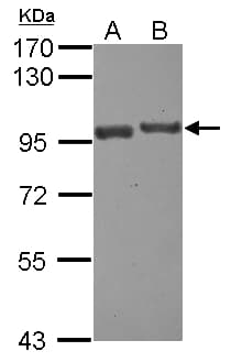 Polyclonal Rabbit anti-Human USP6NL Antibody (N-Terminus, WB)