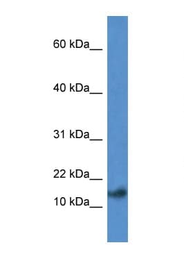 PSENEN / PEN-2 Antibody (aa20-69)