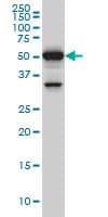 PTBP3 / ROD1 Antibody (clone 4C9)