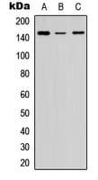 COL5A2 / Collagen V Alpha 2 Antibody (C-Terminus)