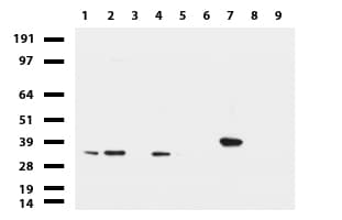 LGALS3 / Galectin 3 Antibody (clone UMAB189, Carrier-free)