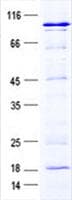 Human LTV1 Protein (Recombinant GST, N-terminus + His, C-terminus)
