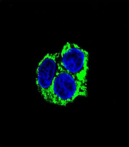 ADCK3 / CABC1 Antibody