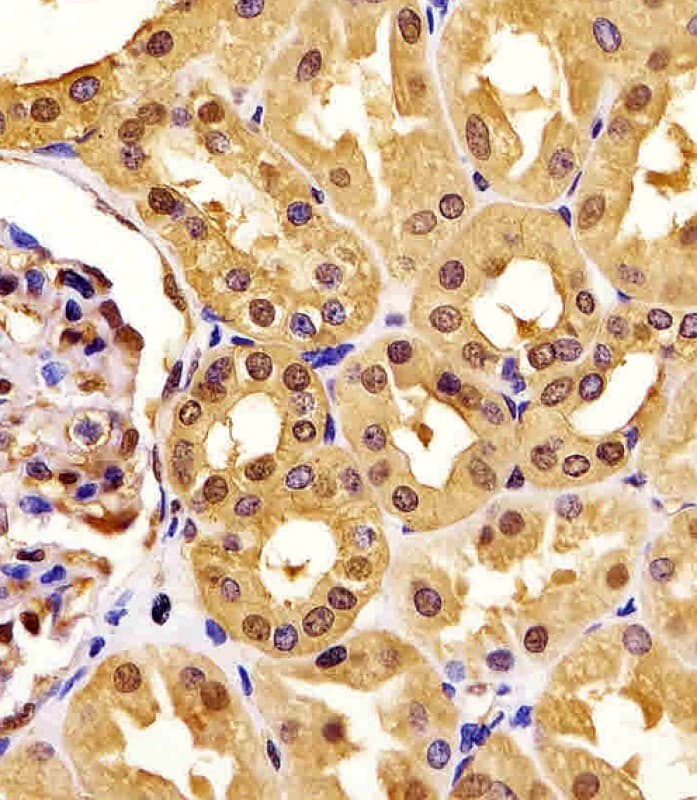 PGK1 / Phosphoglycerate Kinase Antibody (clone 1086CT10.2.1)