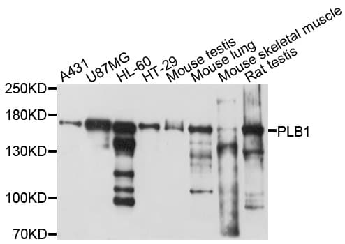 PLB1 Antibody (aa1110-1415)