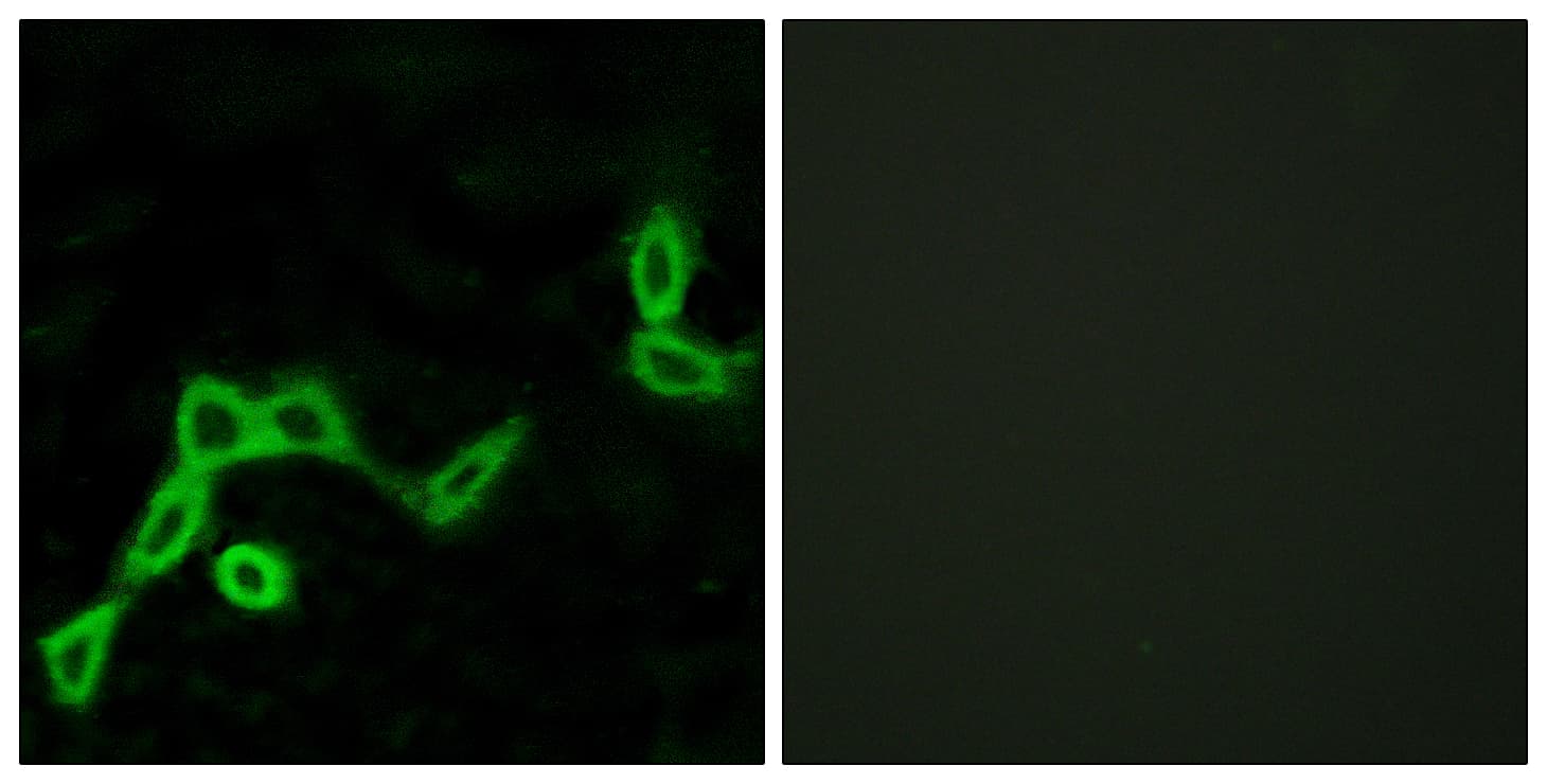 KISS1R / GPR54 Antibody (aa301-350)