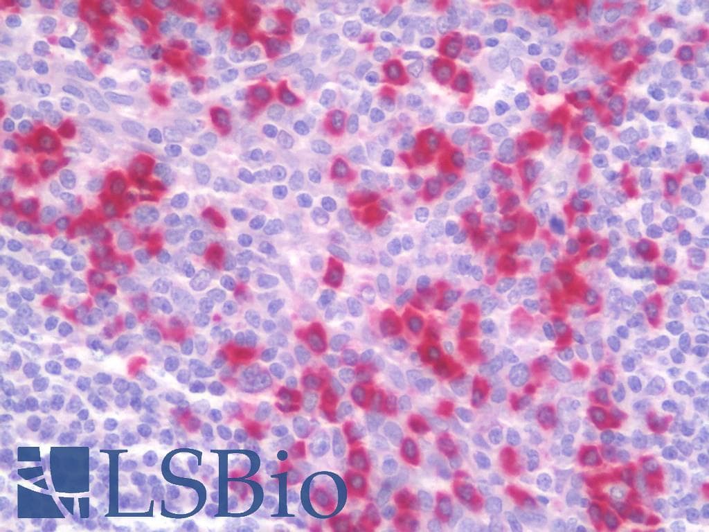 IHC-plus™ DNAJB11 Antibody (aa31-80)