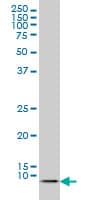 ATOX1 Antibody (clone 2E6)