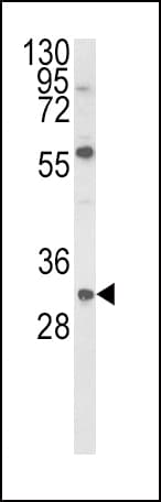 GDNF Antibody (aa8-36)