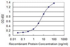 ZSCAN21 / Zipro1 Antibody (clone 4B11)