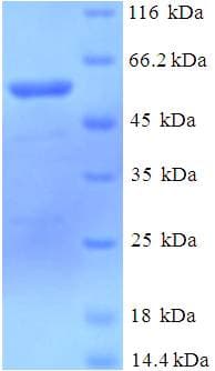 Human DCAF7 / WDR68 Protein (Recombinant His-SUMO)