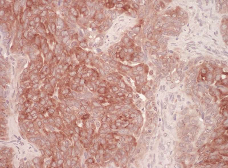 Polyclonal Rabbit anti-Human DERL1 / Derlin 1 Antibody (aa201-251, IHC, WB)
