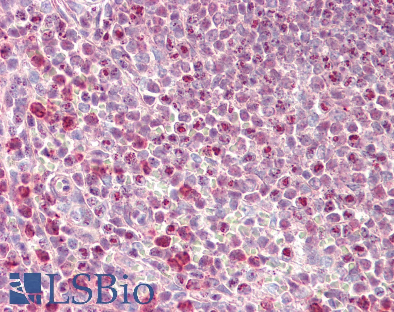 IHC-plus™ PHLPP2 / PHLPPL Antibody