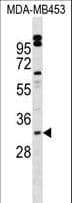 VENTX Antibody (aa58-87)