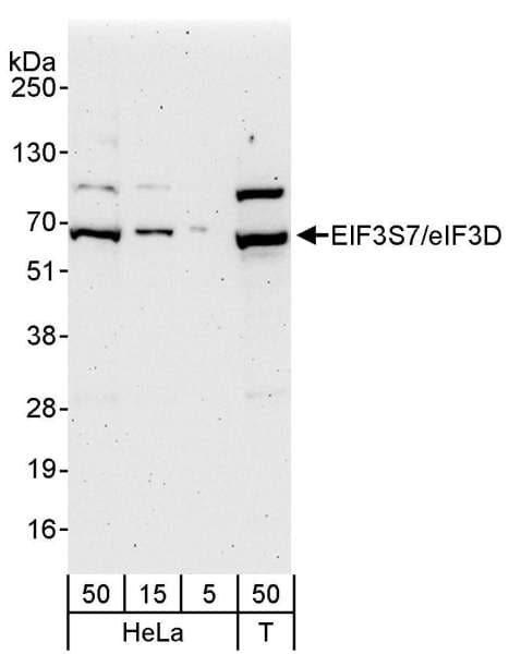 Polyclonal Rabbit anti-Human EIF3D Antibody (aa200-250, WB)