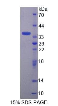 Mouse TNRC6A / GW182 Protein (Recombinant His-T7)