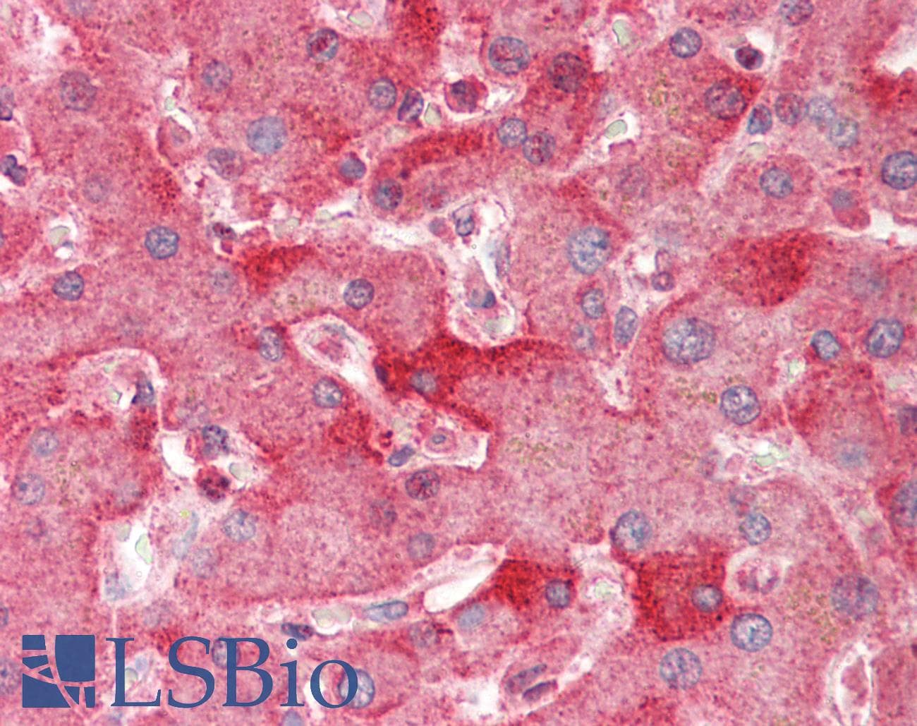 IHC-plus™ ENPP2 / Autotaxin Antibody (aa698-712)