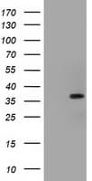 Monoclonal Mouse anti-Human ACAT2 Antibody (clone OTI1G6, IHC, IF, WB)