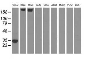 SULT2A1 / Sulfotransferase 2A1 Antibody (clone OTI2A6)