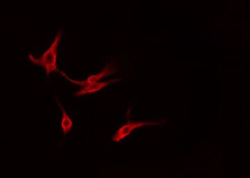 Polyclonal Rabbit anti-Human YWHAG / 14-3-3 Gamma Antibody (IHC, IF, WB)