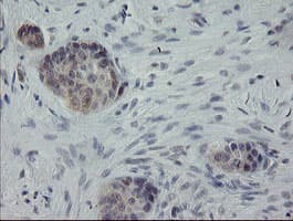 APP / Beta Amyloid Precursor Antibody (clone OTI6F11, Carrier-free)